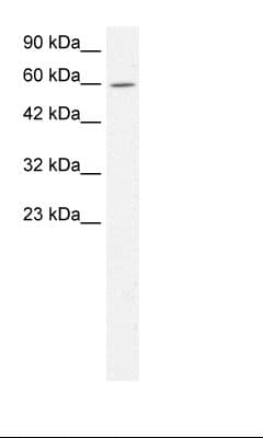 TRIM15 Antibody (aa141-190)
