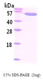 Human NAMPT / Visfatin Protein (Recombinant His)