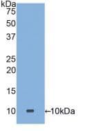 DEFA3 / Defensin Alpha 3 Antibody (aa21-94)