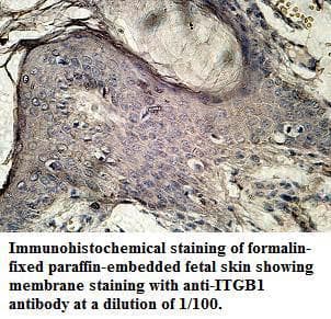 Polyclonal Rabbit anti-Human ITGB1 / Integrin Beta 1 / CD29 Antibody (aa94-356, IHC, WB)