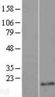 JUB / Ajuba Protein (Over-Expression Lysate Myc-DDK (Flag))