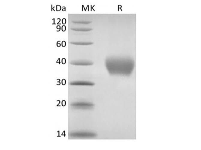 Rhesus monkey TNFRSF1B / TNFR2 Protein (Recombinant 6His, C-terminus)
