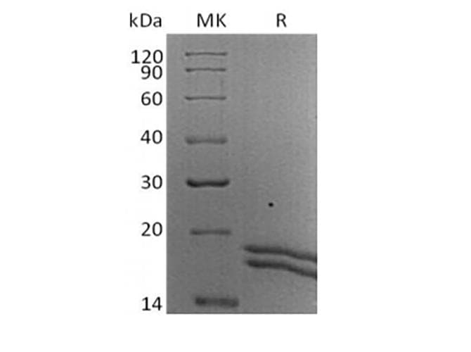 Human IL2 Protein (Recombinant AVI-6His, C-terminus)
