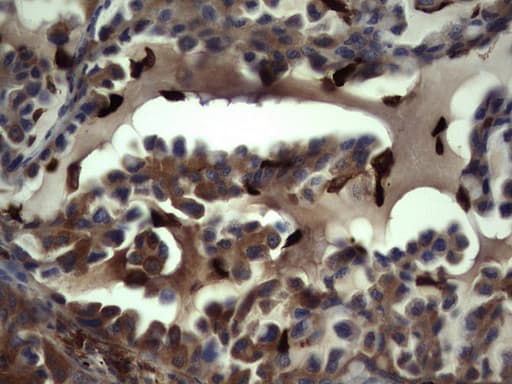 S100A9 / MRP14 Antibody (clone OTI8C2)