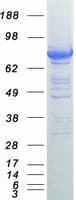 Human CYPOR / POR Protein (Recombinant Myc-DDK (Flag))