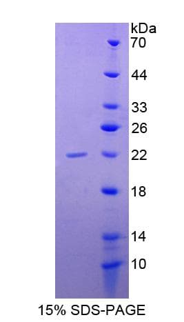 Human CD40 Protein (Recombinant His-T7)