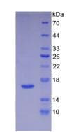 Human IL16 Protein (Recombinant His, N-Terminal)