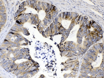 RPS6 / Ribosomal Protein S6 Antibody