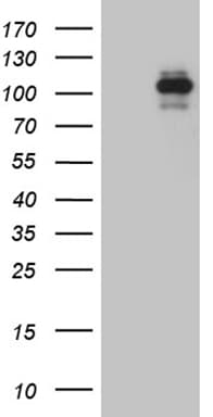 Monoclonal Mouse anti-Human ROR2 Antibody (clone OTI3F8, aa796-927, IHC, WB)