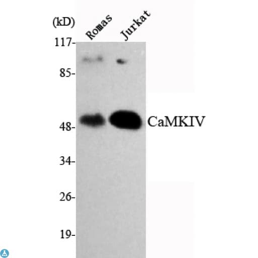 Monoclonal Mouse anti-Human CAMK4 / CaMK IV Antibody (WB)