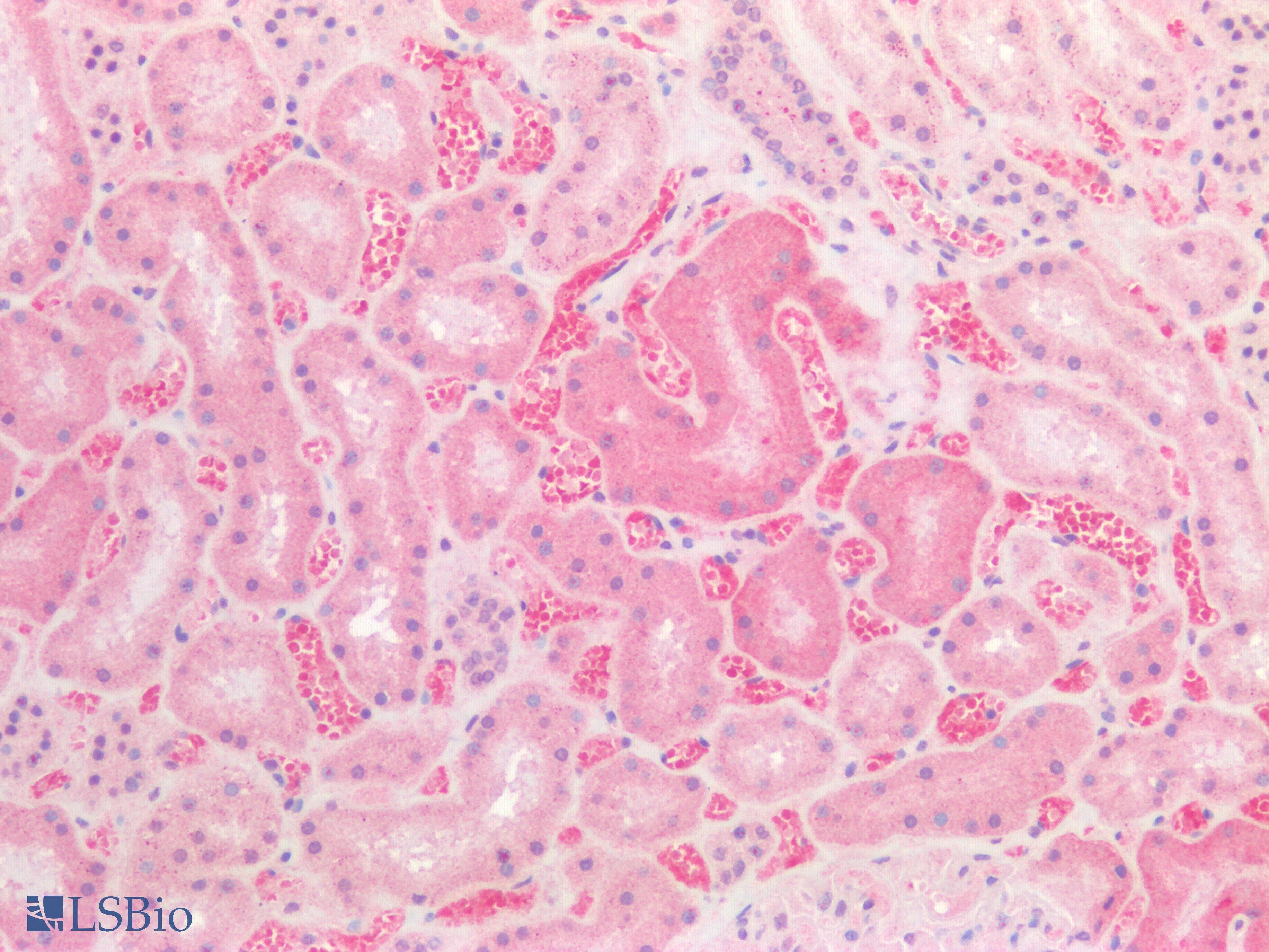 PathPlus™ SLC2A2 / GLUT2 Antibody