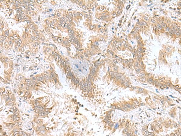 CPLX3 Antibody