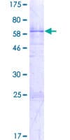 Human HNRPA1 / HnRNP A1 Protein (Recombinant GST)