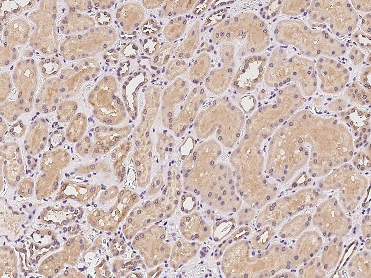 MTMR12 Antibody