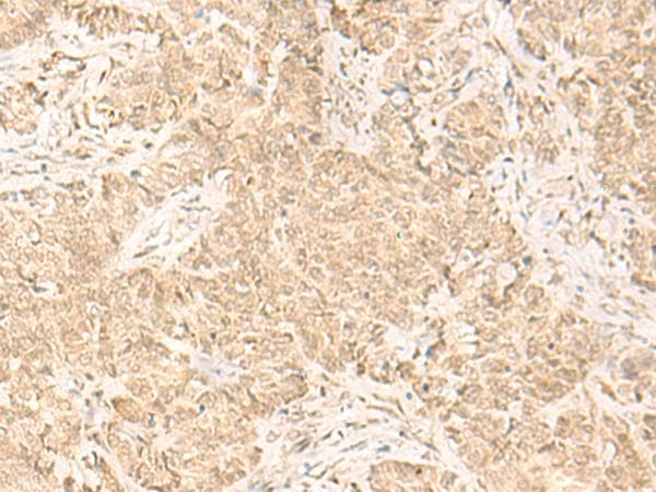 Polyclonal Rabbit anti-Human IL32 Antibody (IHC)