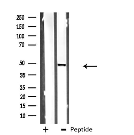Polyclonal Rabbit anti-Human DHODH Antibody (IHC, IF, WB)
