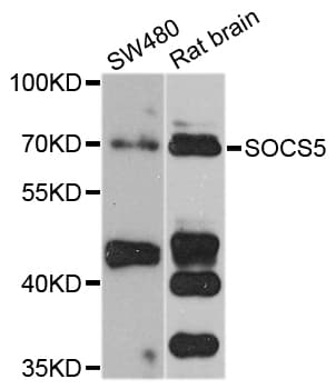 Polyclonal Rabbit anti-Human SOCS5 Antibody (WB)
