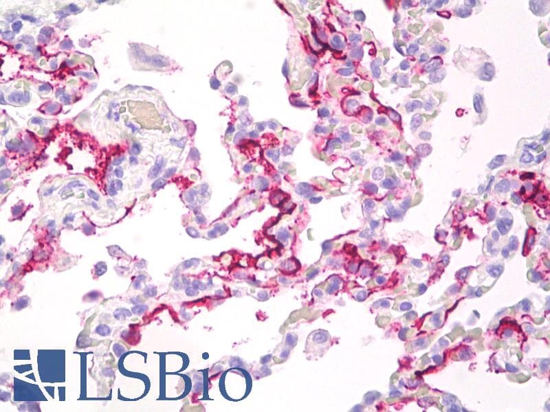 PathPlus™ EMA / MUC1 Antibody (clone 139H2)