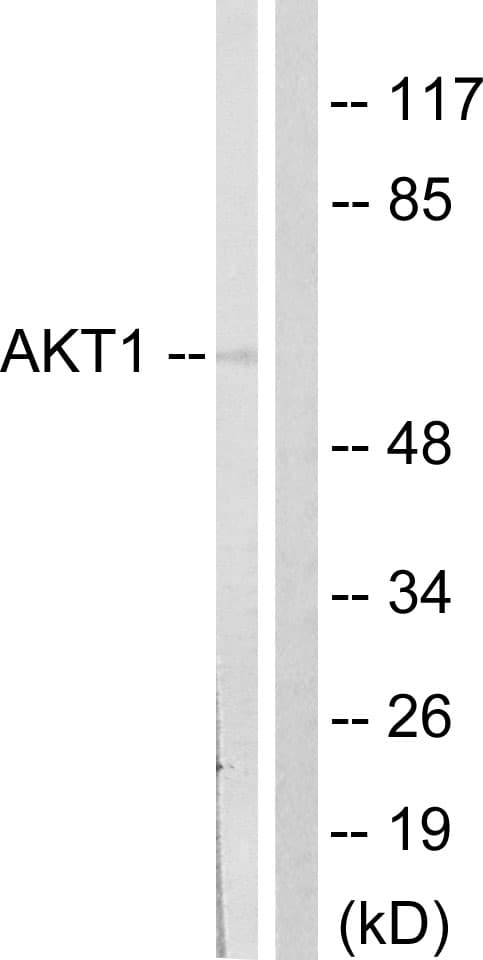 Polyclonal Rabbit anti-Human AKT1 Antibody (aa90-139, WB)
