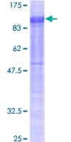 Human NR4A1 / NUR77 Protein (Recombinant GST)