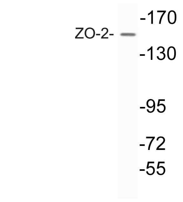 TJP2 / ZO2 / ZO-2 Antibody (aa1063-1112)