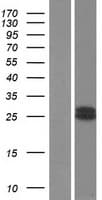 GH2 Protein (Over-Expression Lysate Myc-DDK (Flag))