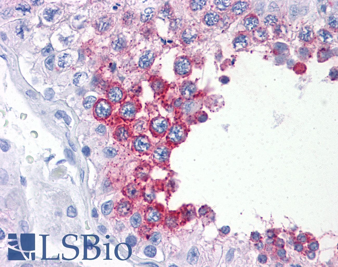 IHC-plus™ ART3 Antibody (clone 3A2)