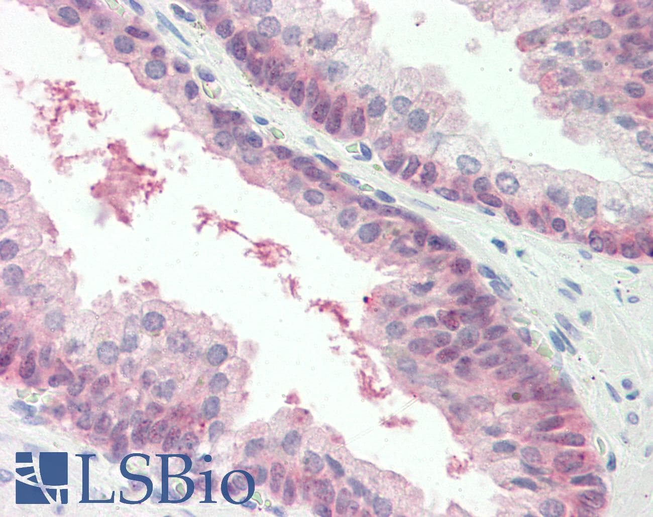 MARCH2 Antibody (aa146-195)