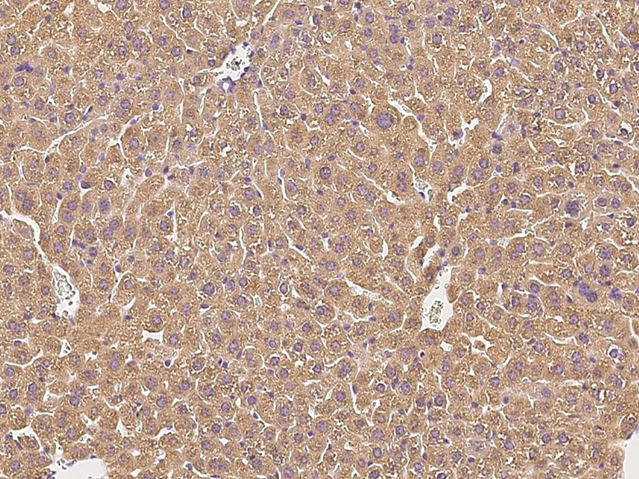 CFH / Complement Factor H Antibody (clone 012, Preservative Free)