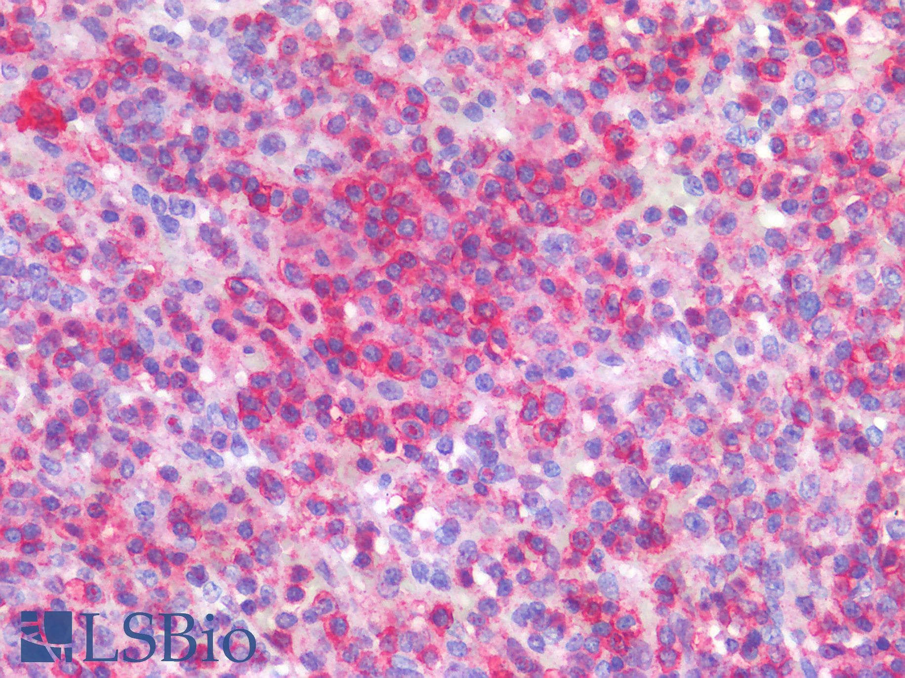 IHC-plus™ CD45 / LCA Antibody