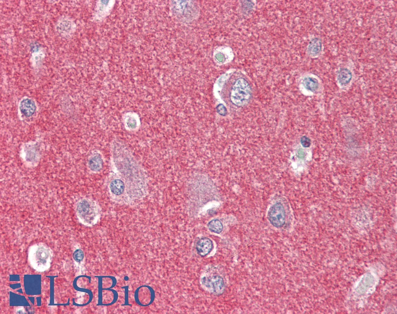 IHC-plus™ ARHGEF17 / TEM4 Antibody
