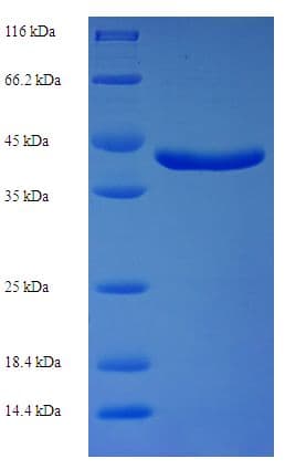 Bacillus licheniformis CwlM Protein (Recombinant His-SUMO)