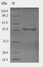 Phanerochaete chrysosporium CDH-1 Protein (Recombinant 6His-SUMO, N-terminus)
