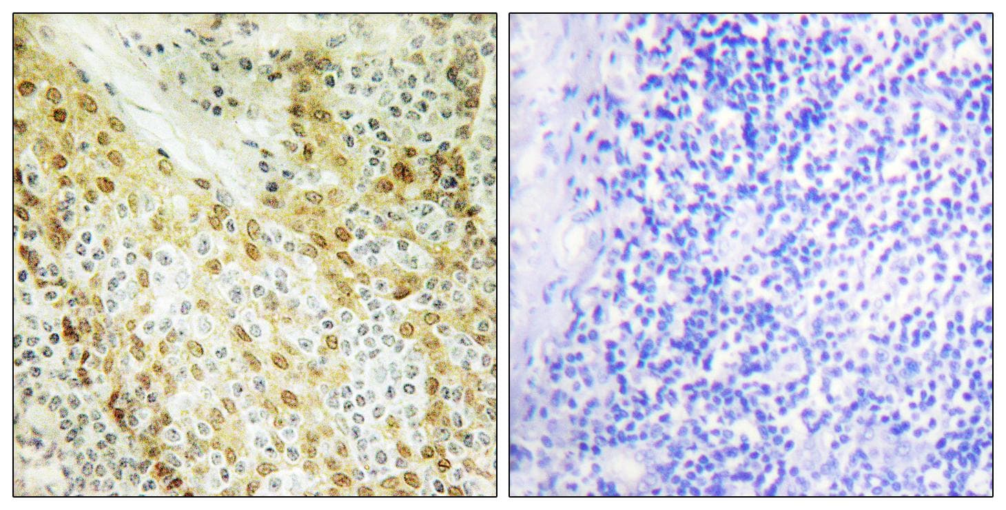 HIRA Antibody (Ab-555)