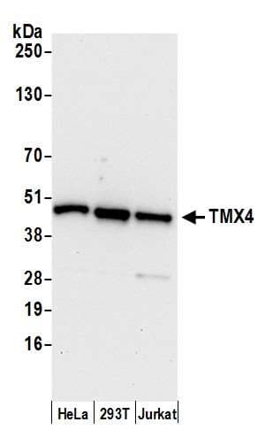 Polyclonal Rabbit anti-Human TMX4 Antibody (aa299-349, WB)