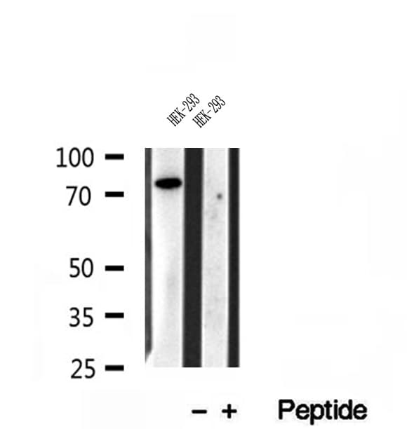IFT81 Antibody