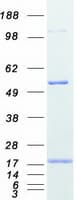 Human PFN2 / Profilin 2 Protein (Recombinant Myc-DDK (Flag))