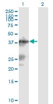 LACC1 Antibody (clone 2A1)