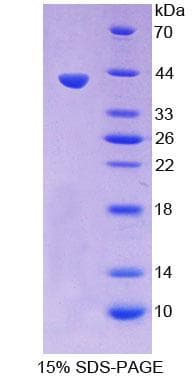 Mouse GFRA1 / GFR Alpha Protein (Recombinant His-GST)
