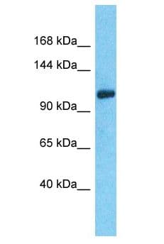 C14orf106 Antibody (aa917-966)