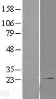 COMMD1 Protein (Over-Expression Lysate Myc-DDK (Flag))