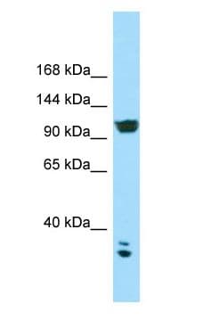 CACNA2D2 Antibody (aa1030-1079)