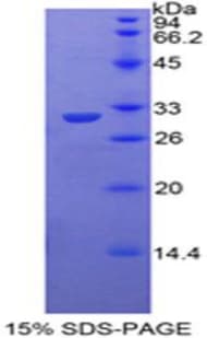 Mouse TOLLIP Protein (Recombinant His-T7)