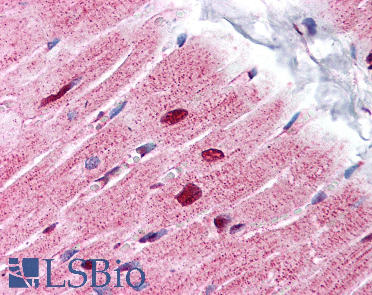 PHAP1 / ANP32A Antibody