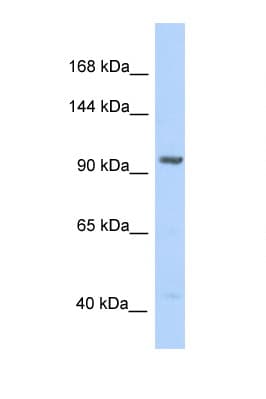 Polyclonal Rabbit anti-Human IDE Antibody (aa90-139, WB)