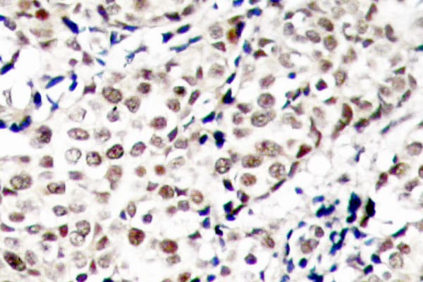 CHEK1 / CHK1 Antibody (phospho-Ser345)