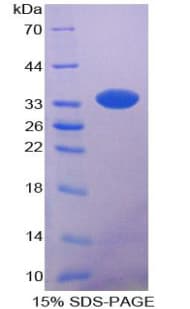 Rat CYP7A1 Protein (Recombinant His-T7)