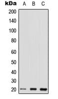 RHOQ / TC10 Antibody (Internal)