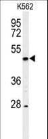 RIPK3 / RIP3 Antibody (aa489-518)