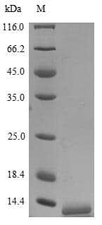 Human IL8 / Interleukin 8 Protein (Recombinant 6His, N-terminus)